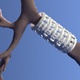 Image for article titled These 3D-Printed Devices Can Repair Damaged Airways in Kids' Lungs